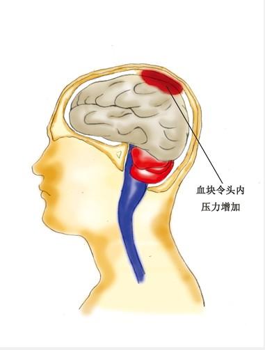 悟空问答中如何上传视频(悟空问答中如何取消收益)